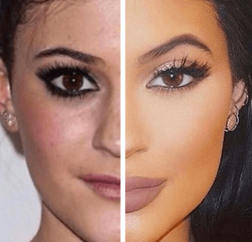 Eyebrow Lift 2 Eyebrow Lift 2