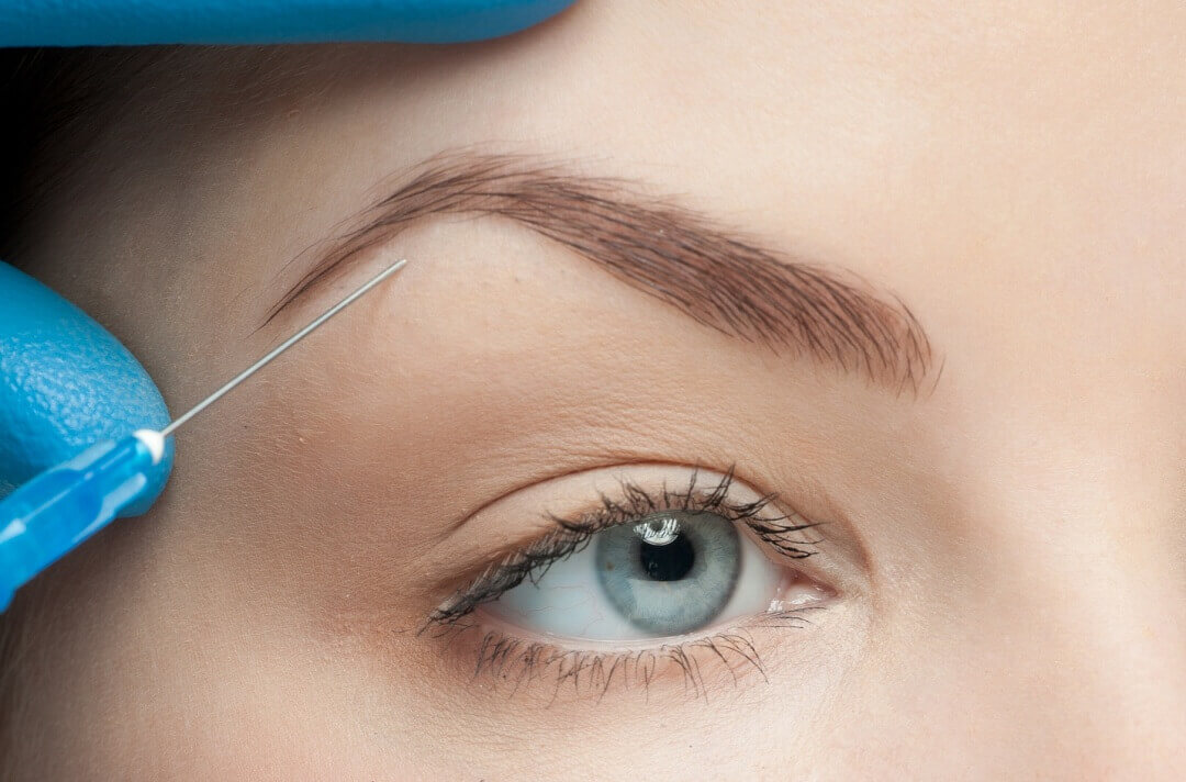 https://promarwellness.com/wp-content/uploads/2021/04/Eyebrow-Lifting-3.jpg