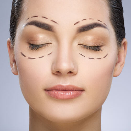 https://promarwellness.com/wp-content/uploads/2021/04/Eyelid-surgery-3.jpg