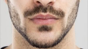 https://promarwellness.com/wp-content/uploads/2021/04/Mustache-Transplant-2.jpg