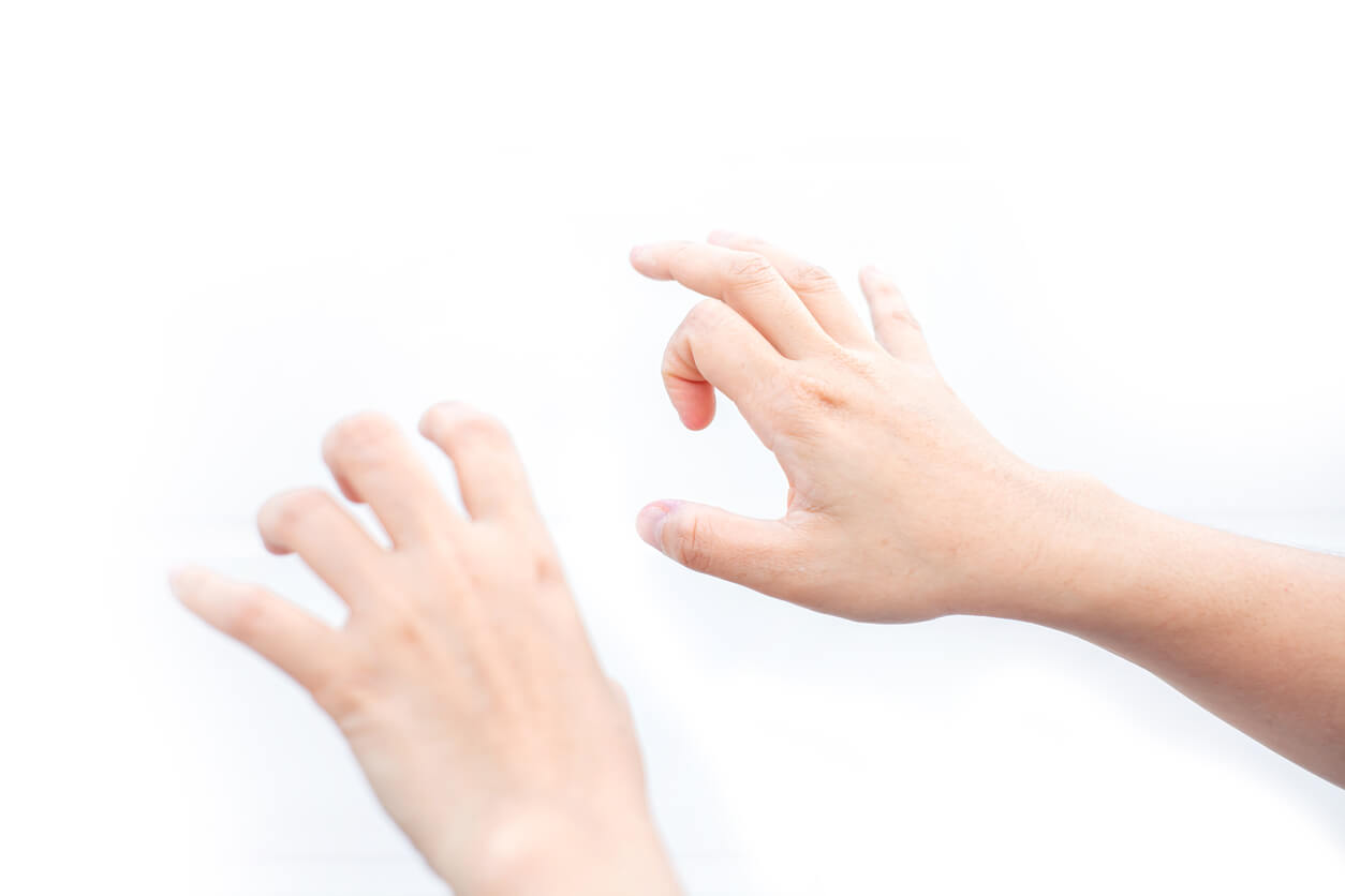 Nonsurgical Treatment of Trigger Finger