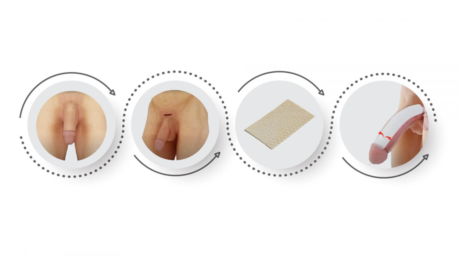 https://promarwellness.com/wp-content/uploads/2021/04/Penis-Thickening-3.jpeg