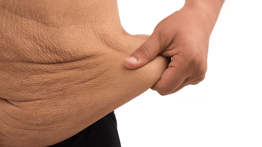 Post-Bariatric Procedures