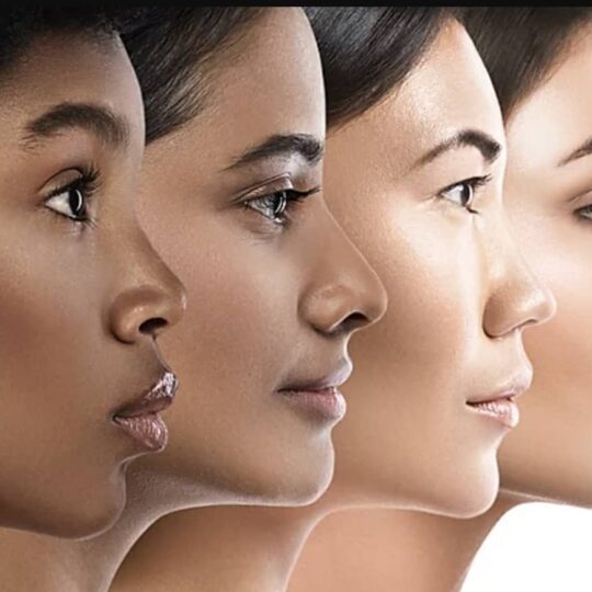 Rhinoplasty 2 Rhinoplasty 2